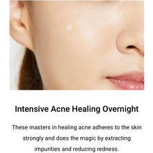 Load image into Gallery viewer, Acne Pimple Master Patch ( 24 patches )l